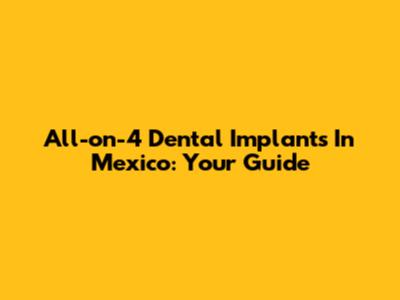 All-on-4 Dental Implants In Mexico: Your Guide