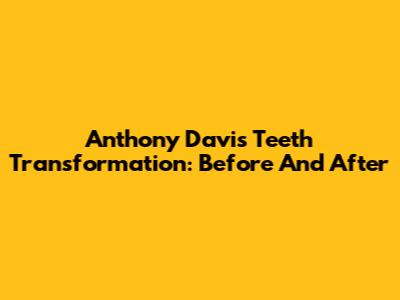 Anthony Davis' Teeth Transformation: Before And After