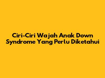 Ciri-Ciri Wajah Anak Down Syndrome Yang Perlu Diketahui