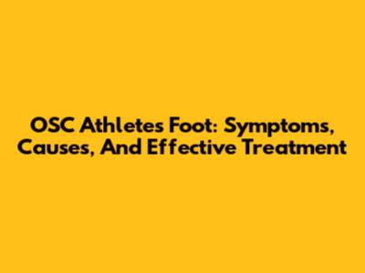 OSC Athletes Foot: Symptoms, Causes, And Effective Treatment