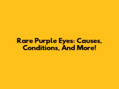 Rare Purple Eyes: Causes, Conditions, And More!