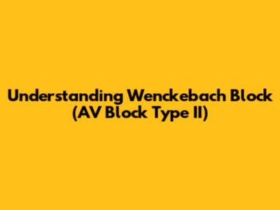 Understanding Wenckebach Block (AV Block Type II)